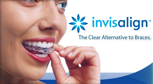 Invisalign® - Smile Dental Clinic, Hopton, Great Yarmouth